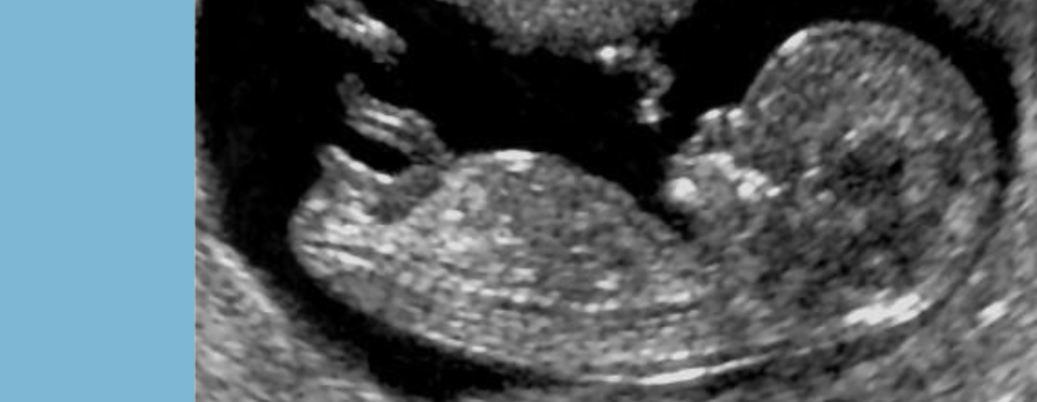 Hands-on training Echoscopie